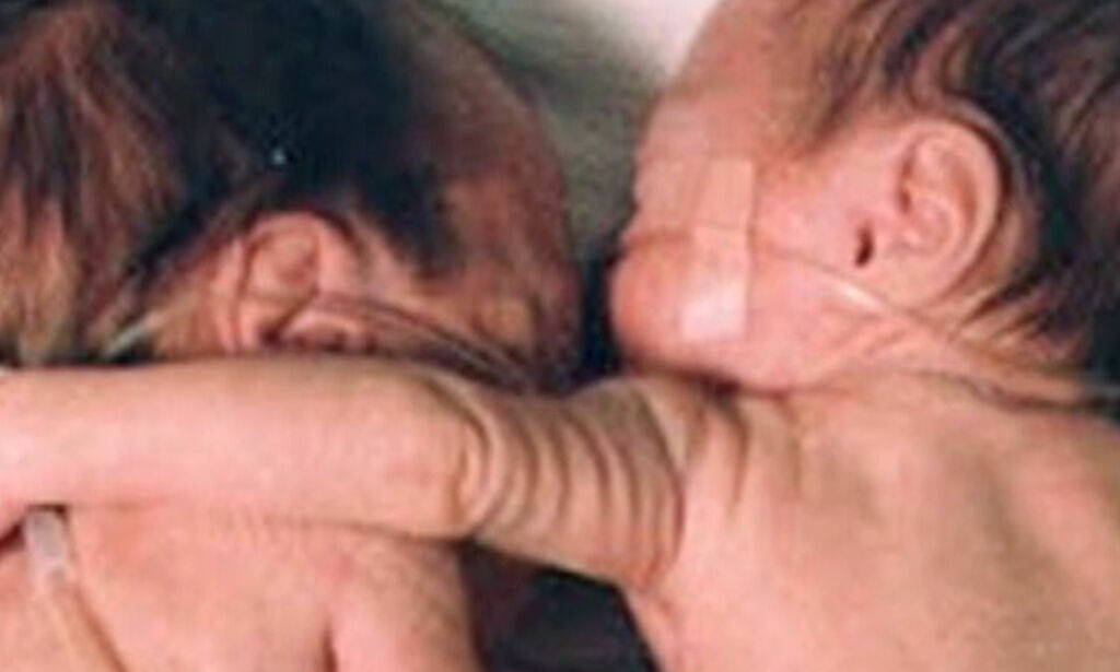 Denne klemmen i 1995 reddet et liv, og førte til store endringer